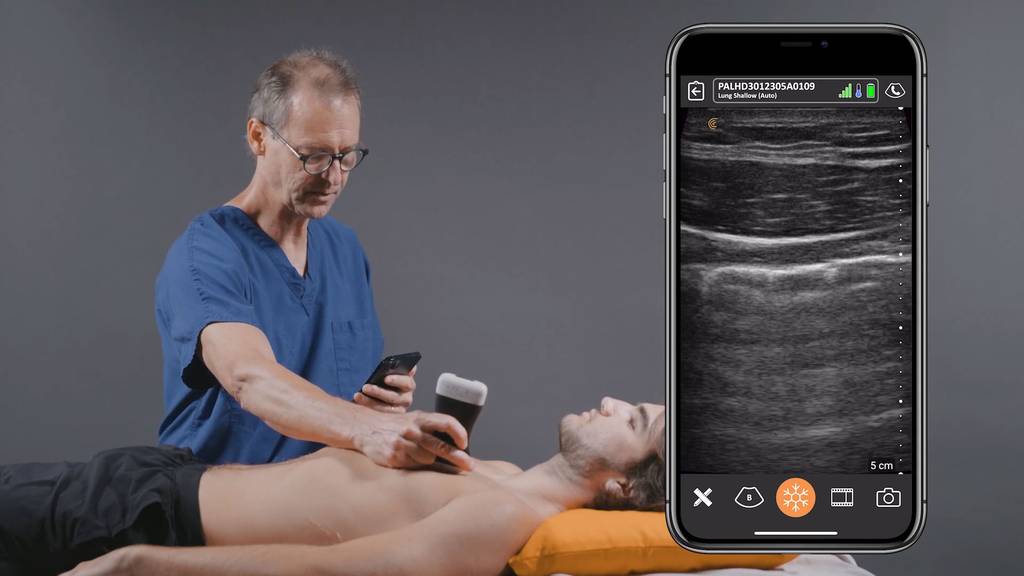 Ecografi palmari per Shock Room | Pronto Soccorso