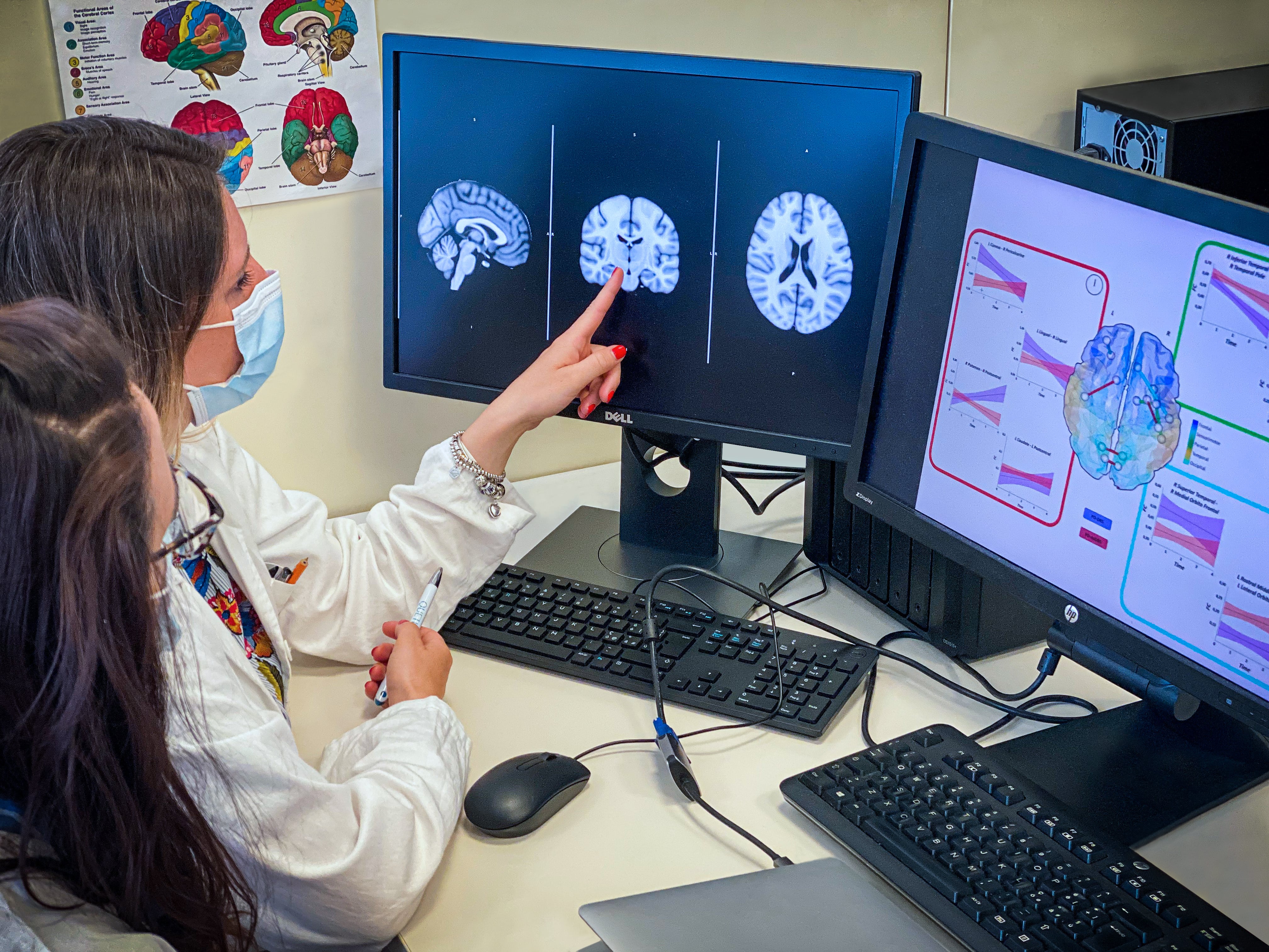 Ricerca malattie neurodegenerative